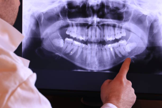Best Emergency Gum Treatment in Nooksack, WA